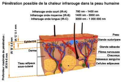 les lampes infrarouges 